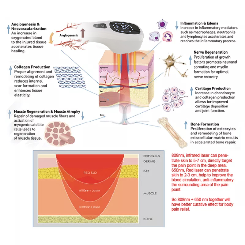 2x808nm Cold Laser Therapy Dev - Badminton Bag review and price